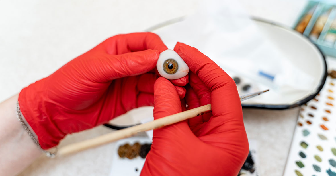 Le coût des prothèses oculaires